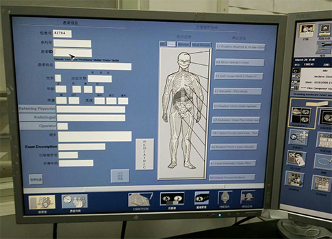 天地智慧醫(yī)療射線系統(tǒng)界面設(shè)計

界面設(shè)計 | 交互設(shè)計











